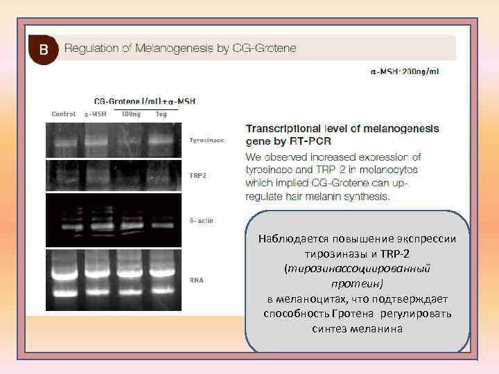 Наблюдается повышение экспрессии тирозиназы и TRP-2 (тирозинассоциированный протеин) в меланоцитах, что подтверждает способность Гротена