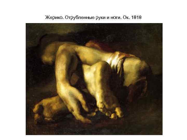 Жерико. Отрубленные руки и ноги. Ок. 1818 