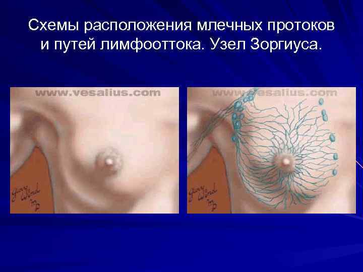 Схемы расположения млечных протоков и путей лимфооттока. Узел Зоргиуса. 