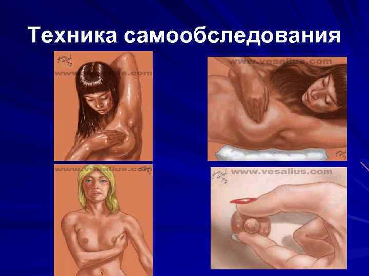 Техника самообследования 