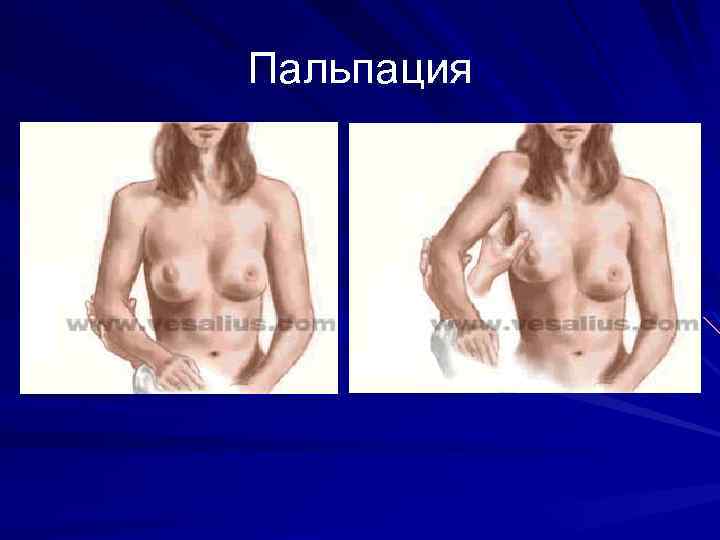 Пальпация 