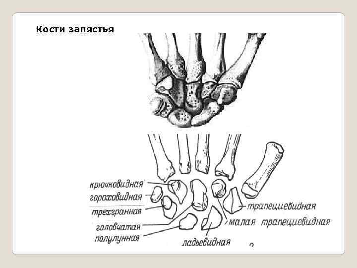 Лучезапястная кость. Анатомия костей запястья рентген. Схема костей лучезапястного сустава.