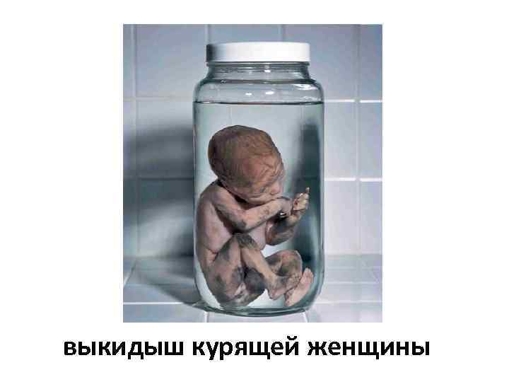 выкидыш курящей женщины 
