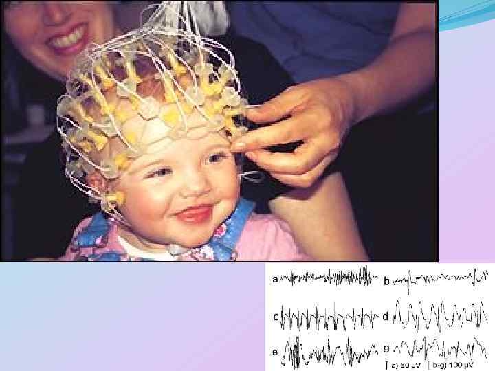 Мозг ребенка видео. ЭЭГ детям. Реоэнцефалография у детей. Энцефалограмма детям. РЭГ головы ребенку.