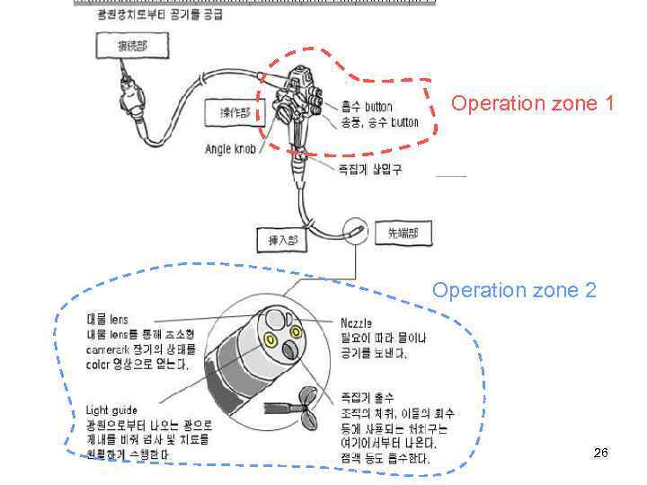 Operation zone 1 Operation zone 2 Dr. Yury_MG Lee_Care Tech 26 