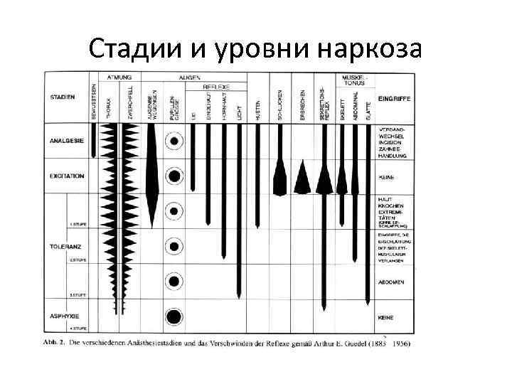 Стадии и уровни наркоза 