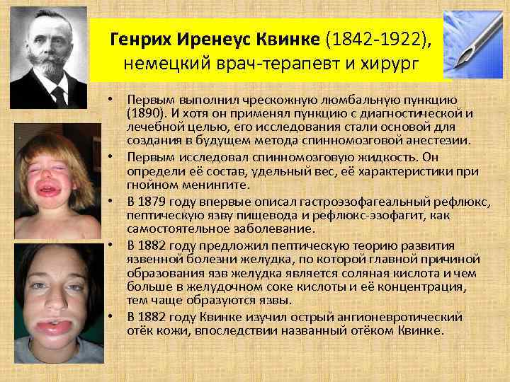 Генрих Иренеус Квинке (1842 -1922), немецкий врач-терапевт и хирург • Первым выполнил чрескожную люмбальную