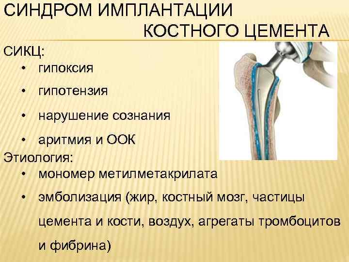 СИНДРОМ ИМПЛАНТАЦИИ КОСТНОГО ЦЕМЕНТА СИКЦ: • гипоксия • гипотензия • нарушение сознания • аритмия