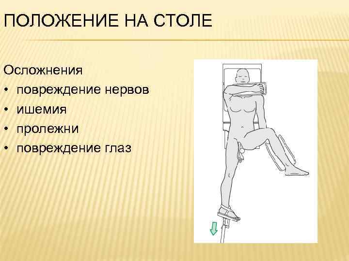 ПОЛОЖЕНИЕ НА СТОЛЕ Осложнения • повреждение нервов • ишемия • пролежни • повреждение глаз