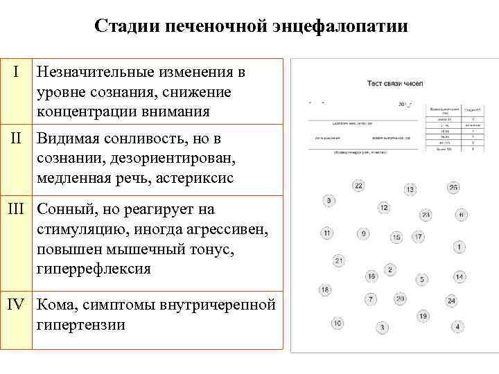 Стадии печеночной энцефалопатии I Незначительные изменения в уровне сознания, снижение концентрации внимания II Видимая