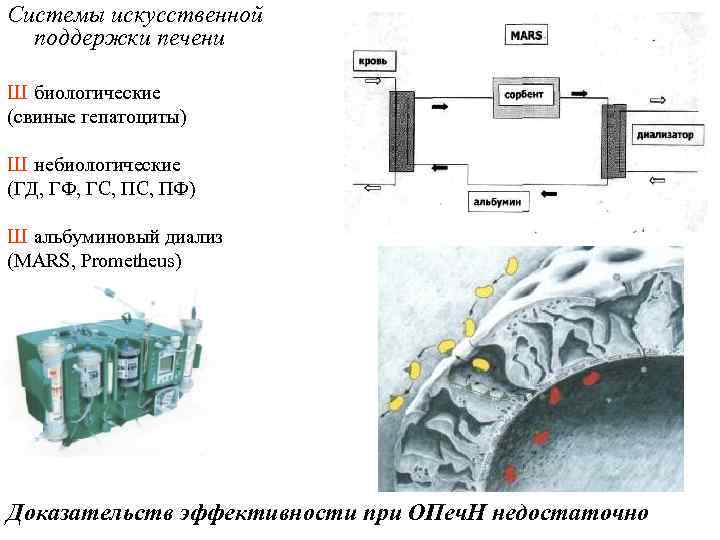 Системы искусственной поддержки печени Ш биологические (свиные гепатоциты) Ш небиологические (ГД, ГФ, ГС, ПФ)