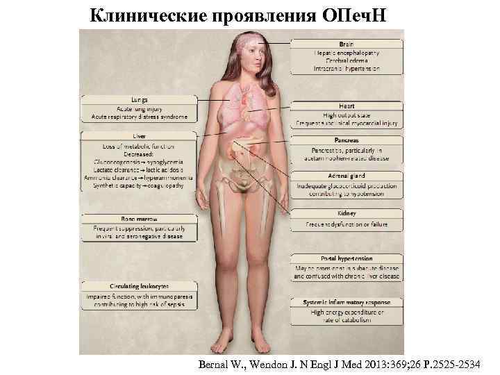 Клинические проявления ОПеч. Н Bernal W. , Wendon J. N Engl J Med 2013: