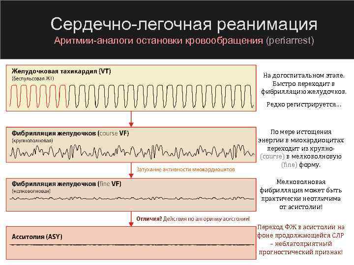 Сердечно легочная реанимация Аритмии аналоги остановки кровообращения (periarrest) На догоспитальном этапе. Быстро переходит в