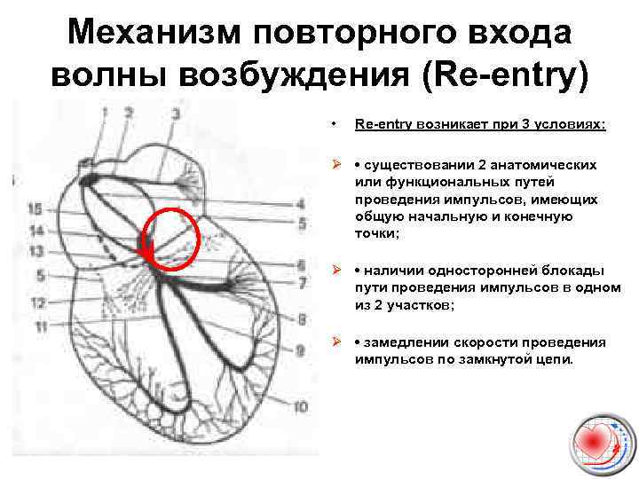 Механизм повторного входа волны возбуждения (Re entry) • Re entry возникает при 3 условиях: