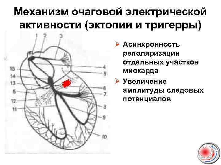 Механизм очаговой электрической активности (эктопии и тригерры) Ø Асинхронность реполяризации отдельных участков миокарда Ø