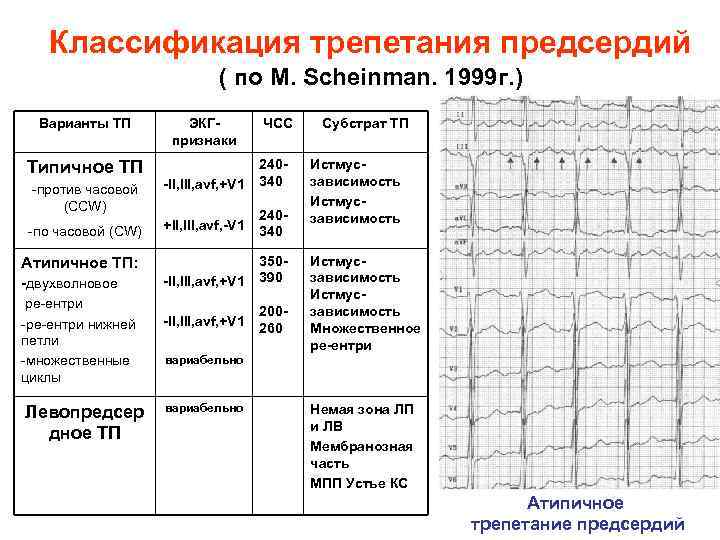 Классификация трепетания предсердий ( по M. Scheinman. 1999 г. ) Варианты ТП ЭКГ признаки