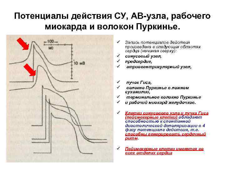 Потенциалы действия СУ, АВ узла, рабочего миокарда и волокон Пуркинье. ü ü ü ü