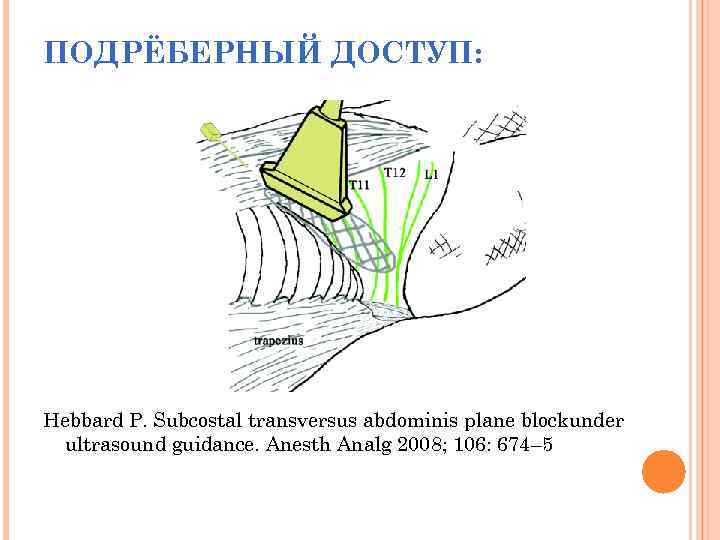 ПОДРЁБЕРНЫЙ ДОСТУП: Hebbard P. Subcostal transversus abdominis plane blockunder ultrasound guidance. Anesth Analg 2008;