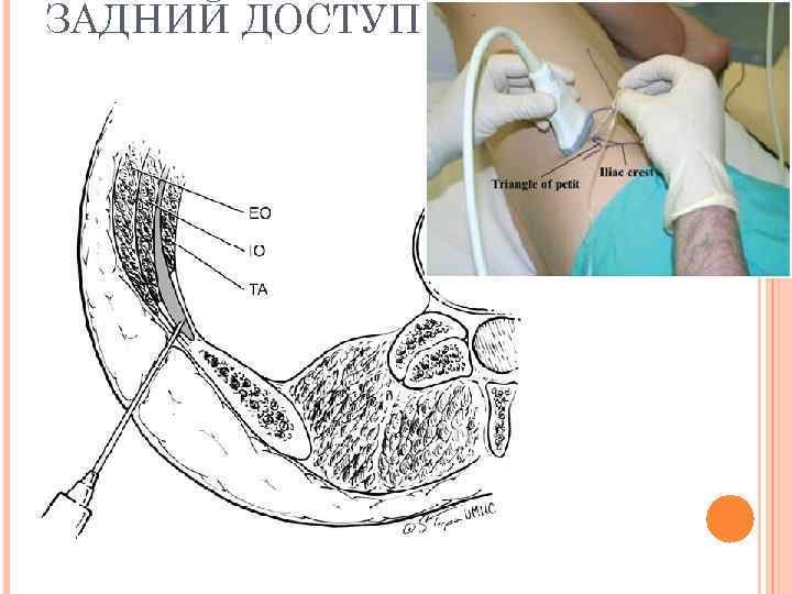 ЗАДНИЙ ДОСТУП 
