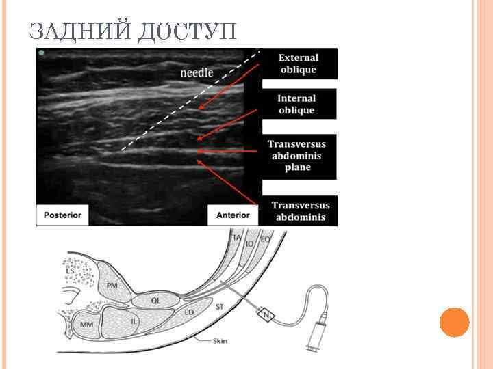 ЗАДНИЙ ДОСТУП 