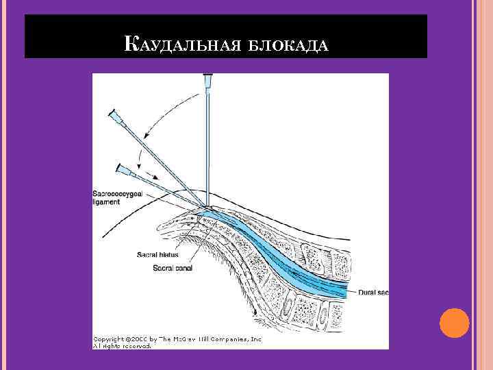 КАУДАЛЬНАЯ БЛОКАДА 