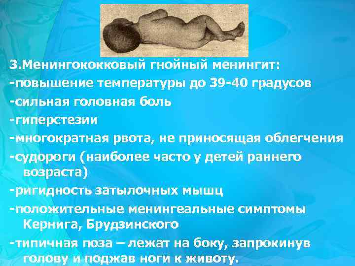 3. Менингококковый гнойный менингит: -повышение температуры до 39 -40 градусов -сильная головная боль -гиперстезии