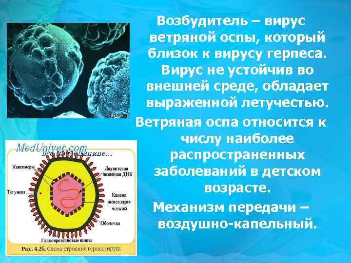 Возбудитель – вирус ветряной оспы, который близок к вирусу герпеса. Вирус не устойчив во