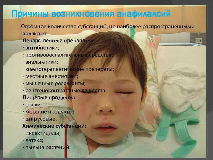 Причины возникновения анафилаксий Огромное количество субстанций, но наиболее распространенными являются: Лекарственные препараты: · антибиотики;
