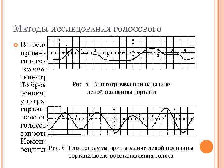 МЕТОДЫ ИССЛЕДОВАНИЯ ГОЛОСОВОГО В последнее время находит все большее применение новый метод исследования голосового