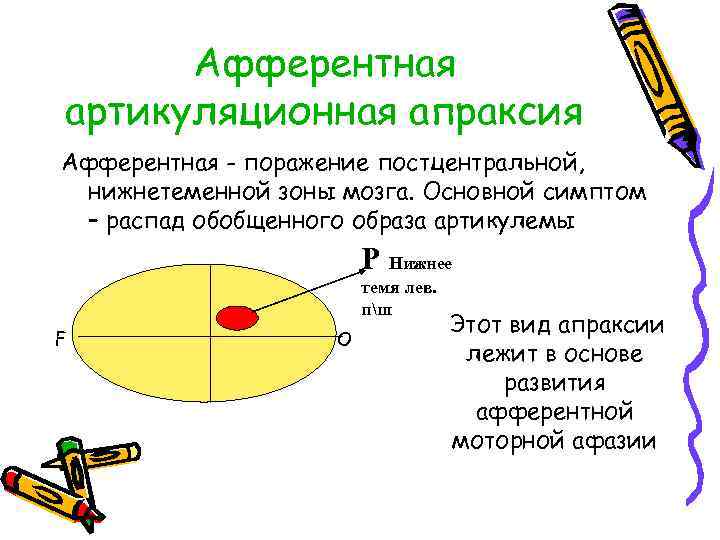 Афферентная артикуляционная апраксия Афферентная - поражение постцентральной, нижнетеменной зоны мозга. Основной симптом – распад