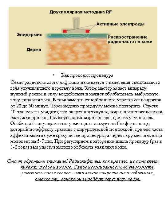  • Как проходит процедура Сеанс радиоволнового лифтинга начинается с нанесения специального геля, улучшающего