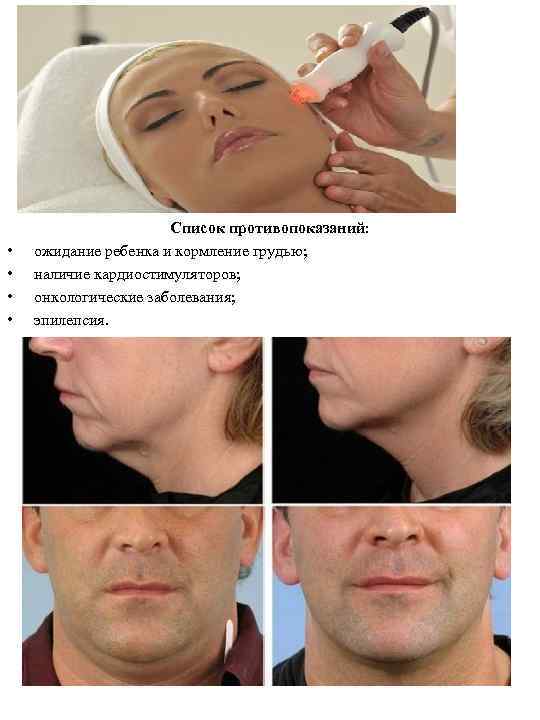  • • Список противопоказаний: ожидание ребенка и кормление грудью; наличие кардиостимуляторов; онкологические заболевания;