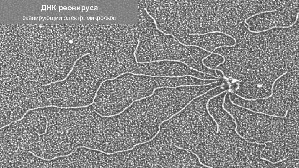 ДНК реовируса сканирующий электр. микроскоп 