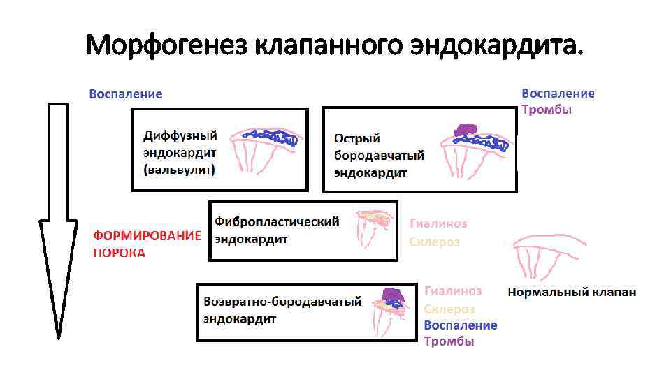 Морфогенез клапанного эндокардита. 