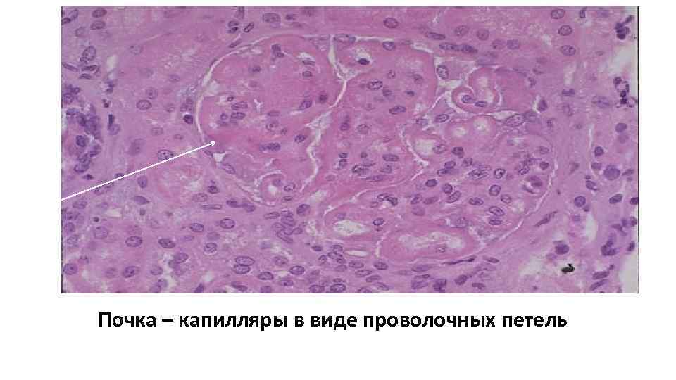 Почка – капилляры в виде проволочных петель 