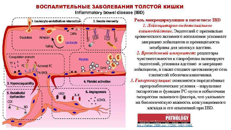 Центр воспалительных заболеваний кишечника