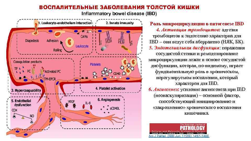 Взк кишечника. Патогенез язвенного колита схема. Хронический неспецифический колит патогенез. Неспецифический язвенный колит патогенез схема. Язвенный илеит этиология патогенез.