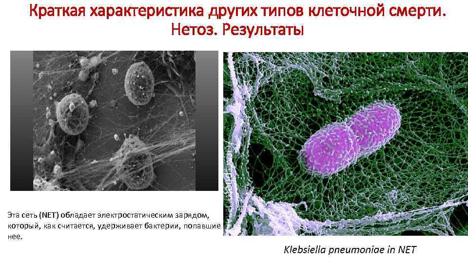 Краткая характеристика других типов клеточной смерти. Нетоз. Результаты Эта сеть (NET) обладает электростатическим зарядом,
