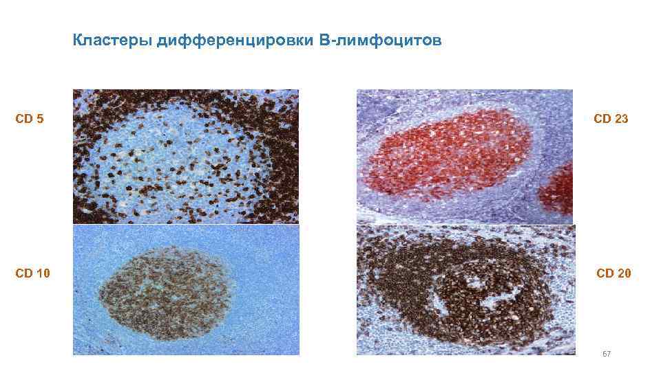 Кластеры дифференцировки В-лимфоцитов CD 5 CD 23 CD 10 CD 20 67 