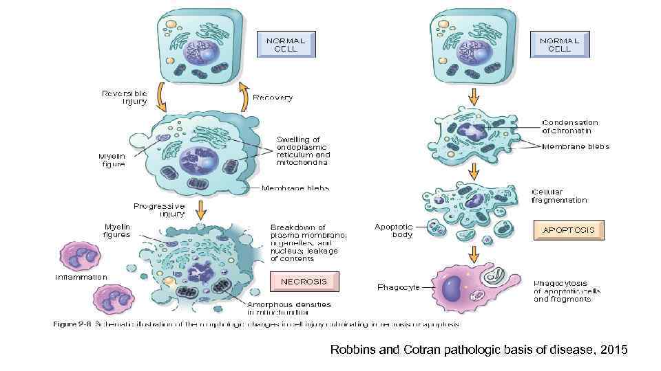 Robbins and Cotran pathologic basis of disease, 2015 