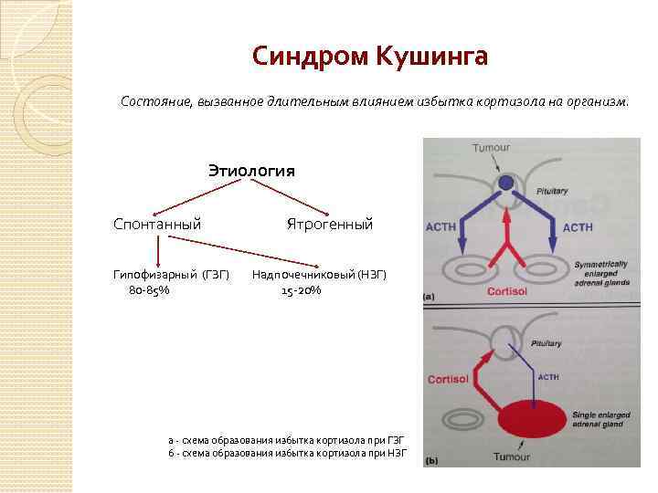 Синдром Кушинга Состояние, вызванное длительным влиянием избытка кортизола на организм. Этиология Спонтанный Гипофизарный (ГЗГ)