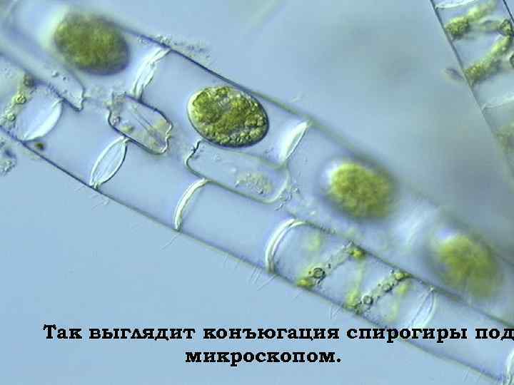 Так выглядит конъюгация спирогиры под микроскопом. 