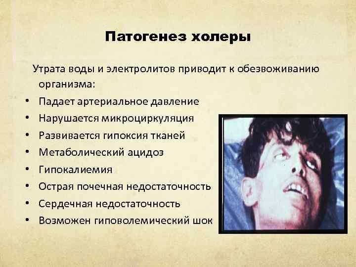 Патогенез холеры Утрата воды и электролитов приводит к обезвоживанию организма: • Падает артериальное давление