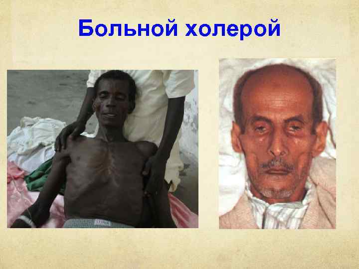 Больной холерой 