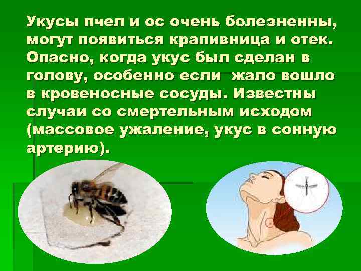 Укусы пчел и ос очень болезненны, могут появиться крапивница и отек. Опасно, когда укус