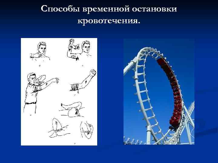 Cпособы временной остановки кровотечения. 