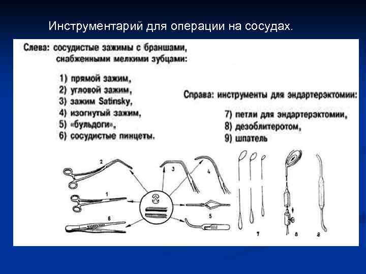 Инструментарий для операции на сосудах. 