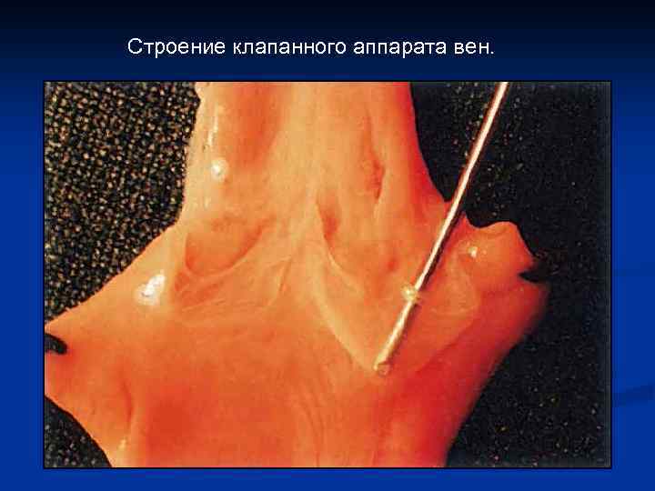 Строение клапанного аппарата вен. 