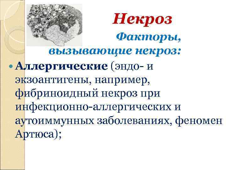 Некроз Факторы, вызывающие некроз: Аллергические (эндо- и экзоантигены, например, фибриноидный некроз при инфекционно-аллергических и