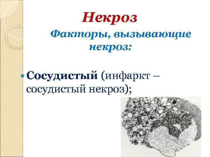 Некроз Факторы, вызывающие некроз: Сосудистый (инфаркт – сосудистый некроз); 
